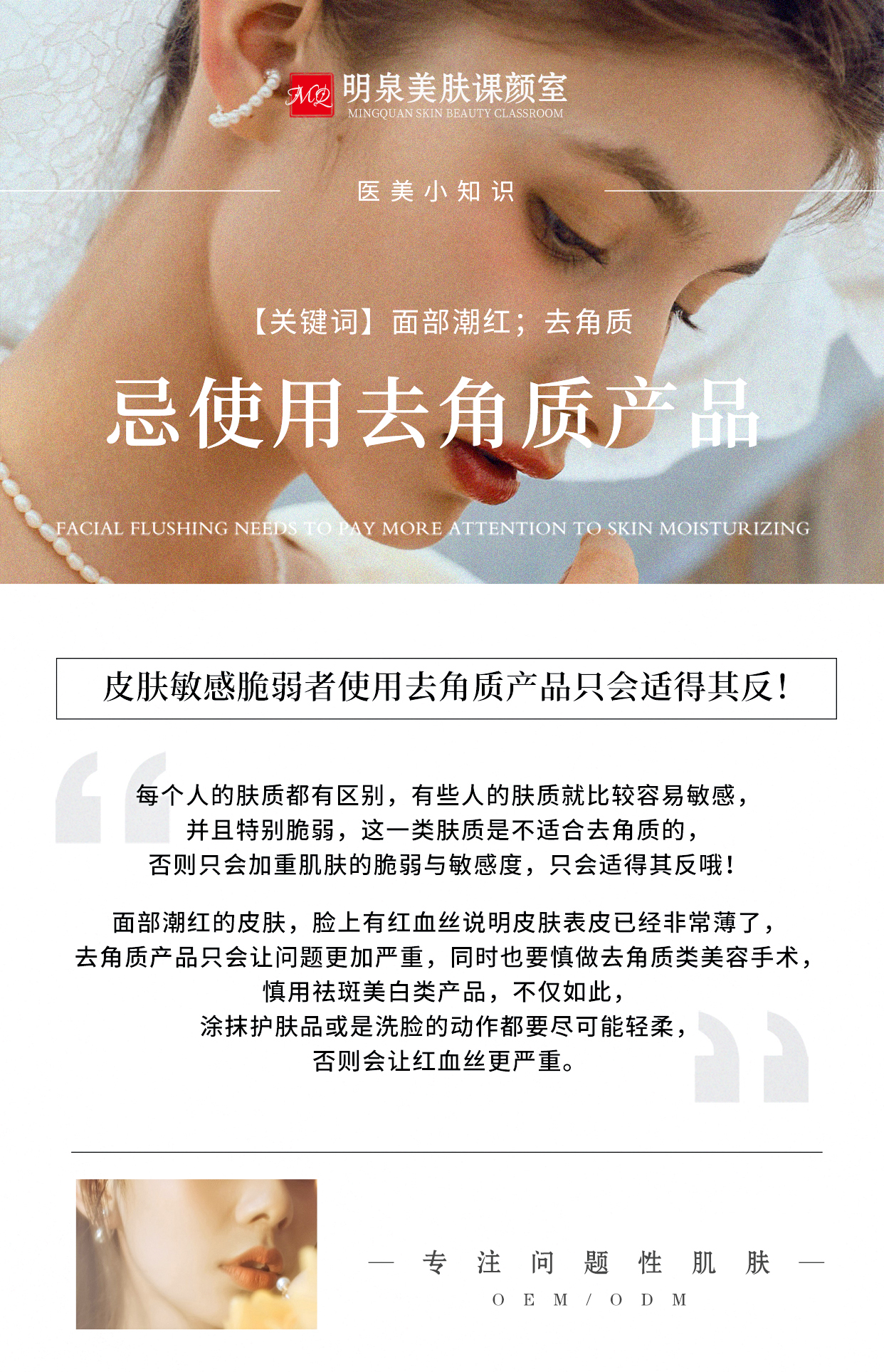 广州博今生物告诉你：关于黑头的这些事情，你知道吗？